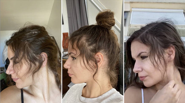 cheveux cassés - casse cheveux près de la racine - petits cheveux cassés - casse à cause élastique - petits cheveux partout - cheveux abimés lisseur - comment arrêter la casse cheveux - petits cheveux - petits cheveux cassés