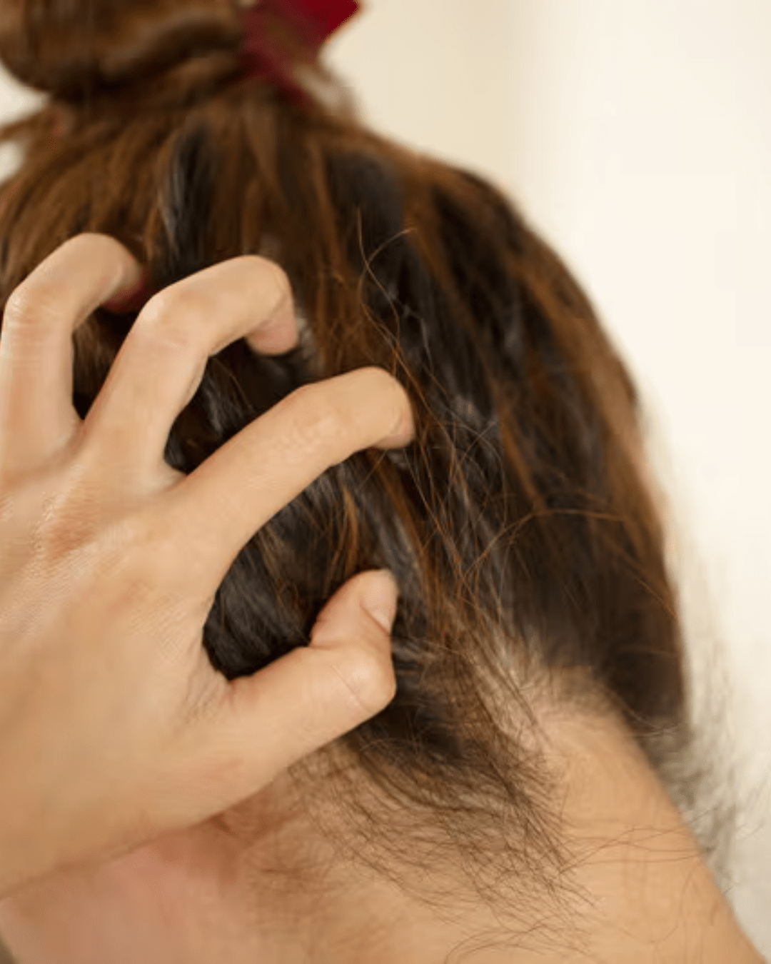 Comment soigner son cuir chevelu naturellement ?